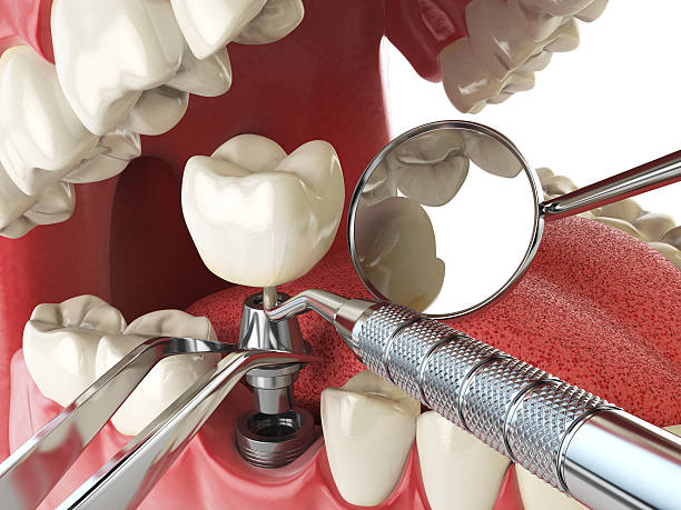 Best Emergency Dental Surgery in Mountain Lakes, NJ